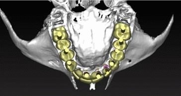 Макет 3д кости и зубов. Клиника Шиба